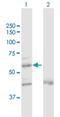 Zinc Finger Protein 92 antibody, H00168374-D01P, Novus Biologicals, Western Blot image 
