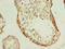 PHD Finger Protein 10 antibody, LS-C376308, Lifespan Biosciences, Immunohistochemistry paraffin image 