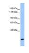 F-Box And WD Repeat Domain Containing 10 antibody, NBP1-79495, Novus Biologicals, Western Blot image 