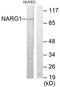 N(Alpha)-Acetyltransferase 15, NatA Auxiliary Subunit antibody, TA315823, Origene, Western Blot image 