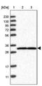 Ubiquitin Protein Ligase E3D antibody, PA5-55552, Invitrogen Antibodies, Western Blot image 
