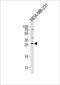 ARP antibody, PA5-48886, Invitrogen Antibodies, Western Blot image 