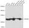 Zinc Finger RANBP2-Type Containing 3 antibody, 23-881, ProSci, Western Blot image 