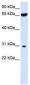 3-Hydroxyacyl-CoA Dehydratase 4 antibody, TA336126, Origene, Western Blot image 