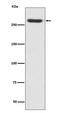 Chondroitin Sulfate Proteoglycan 4 antibody, M03394, Boster Biological Technology, Western Blot image 