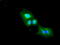 DNA Fragmentation Factor Subunit Alpha antibody, GTX84621, GeneTex, Immunocytochemistry image 