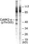 Calcium/Calmodulin Dependent Protein Kinase II Alpha antibody, TA313546, Origene, Western Blot image 