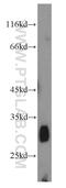 Hematopoietic Prostaglandin D Synthase antibody, 22522-1-AP, Proteintech Group, Western Blot image 