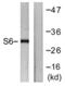 Ribosomal Protein S6 antibody, LS-B6278, Lifespan Biosciences, Western Blot image 