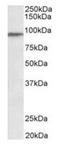Patched Domain Containing 3 antibody, orb12354, Biorbyt, Western Blot image 