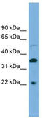 Docking Protein 6 antibody, TA329777, Origene, Western Blot image 