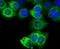 Trefoil Factor 1 antibody, A01391-3, Boster Biological Technology, Immunocytochemistry image 