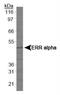 Estrogen Related Receptor Alpha antibody, NBP1-47254, Novus Biologicals, Western Blot image 