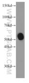 Pancreatic alpha-amylase antibody, 66133-1-Ig, Proteintech Group, Western Blot image 
