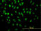 Nuclear Transcription Factor, X-Box Binding 1 antibody, LS-C197777, Lifespan Biosciences, Immunofluorescence image 