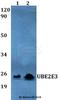 Ubiquitin Conjugating Enzyme E2 E3 antibody, A09303, Boster Biological Technology, Western Blot image 