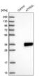 Distal Membrane Arm Assembly Complex 2 antibody, PA5-59568, Invitrogen Antibodies, Western Blot image 