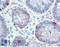 FER Tyrosine Kinase antibody, LS-B15570, Lifespan Biosciences, Immunohistochemistry paraffin image 