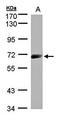 Interleukin 12 Receptor Subunit Beta 1 antibody, orb73629, Biorbyt, Western Blot image 