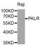 Pyruvate Kinase L/R antibody, MBS126315, MyBioSource, Western Blot image 