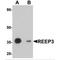 Receptor Accessory Protein 3 antibody, MBS151194, MyBioSource, Western Blot image 