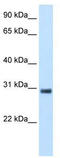 Potassium Channel Tetramerization Domain Containing 6 antibody, TA338740, Origene, Western Blot image 