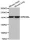 DNA excision repair protein ERCC-6-like antibody, abx001879, Abbexa, Western Blot image 
