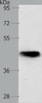 NK2 Homeobox 1 antibody, TA323320, Origene, Western Blot image 