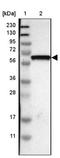 Growth Differentiation Factor 5 antibody, NBP1-88575, Novus Biologicals, Western Blot image 