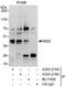 Musashi RNA Binding Protein 2 antibody, A303-216A, Bethyl Labs, Immunoprecipitation image 
