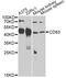 CD63 Molecule antibody, A5271, ABclonal Technology, Western Blot image 