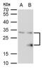 Single-strand selective monofunctional uracil DNA glycosylase antibody, GTX129302, GeneTex, Western Blot image 