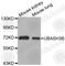 Ubiquitin Associated And SH3 Domain Containing B antibody, A3694, ABclonal Technology, Western Blot image 
