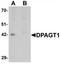 Dolichyl-Phosphate N-Acetylglucosaminephosphotransferase 1 antibody, TA319635, Origene, Western Blot image 