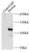 Drebrin 1 antibody, FNab02535, FineTest, Immunoprecipitation image 