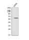 Meiotic recombination protein REC8 homolog antibody, A04915-2, Boster Biological Technology, Western Blot image 