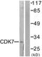 Cyclin Dependent Kinase 7 antibody, TA313154, Origene, Western Blot image 