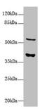 Calcium Homeostasis Modulator 3 antibody, CSB-PA768231LA01HU, Cusabio, Western Blot image 