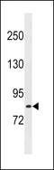 Leucine Rich Repeats And Calponin Homology Domain Containing 1 antibody, LS-C157870, Lifespan Biosciences, Western Blot image 