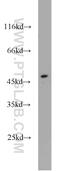 Sterol O-Acyltransferase 2 antibody, 21852-1-AP, Proteintech Group, Western Blot image 