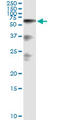 Hyaluronan-binding protein 2 antibody, LS-C197393, Lifespan Biosciences, Immunoprecipitation image 