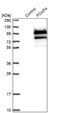 Forkhead Box P4 antibody, NBP1-83449, Novus Biologicals, Western Blot image 