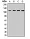 Corin, Serine Peptidase antibody, orb411759, Biorbyt, Western Blot image 