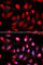 Enhancer Of Zeste 2 Polycomb Repressive Complex 2 Subunit antibody, A5743, ABclonal Technology, Immunofluorescence image 