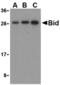 BH3 Interacting Domain Death Agonist antibody, TA306177, Origene, Western Blot image 