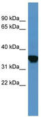 C5a anaphylatoxin chemotactic receptor antibody, TA342835, Origene, Western Blot image 