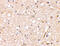 Glutamate Ionotropic Receptor Kainate Type Subunit 1 antibody, 4383, ProSci Inc, Western Blot image 