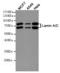 Prelamin-A/C antibody, TA346998, Origene, Western Blot image 