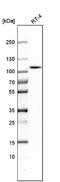 Aldehyde Dehydrogenase 1 Family Member L1 antibody, NBP1-89414, Novus Biologicals, Western Blot image 