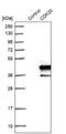 Cyclin Dependent Kinase 20 antibody, NBP1-91215, Novus Biologicals, Western Blot image 